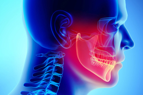 Xray of tmj from The Facial Center in Charleston, WV